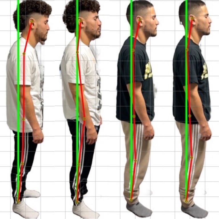 poor posture correction