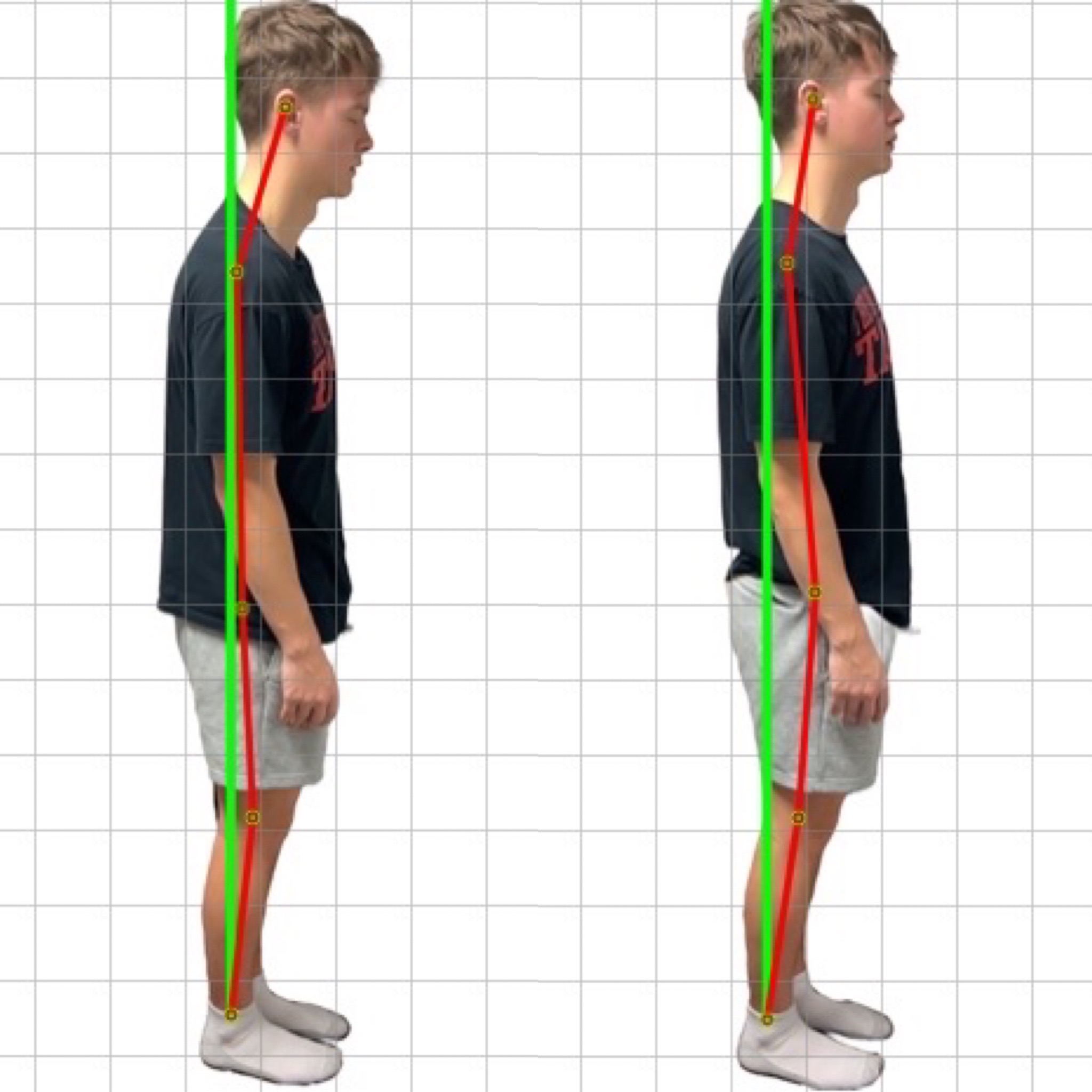 Patient posture transformation 2