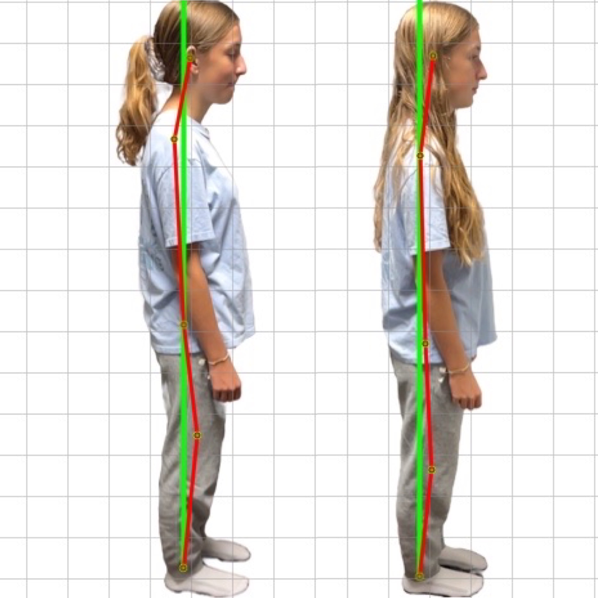 Patient posture transformation 1