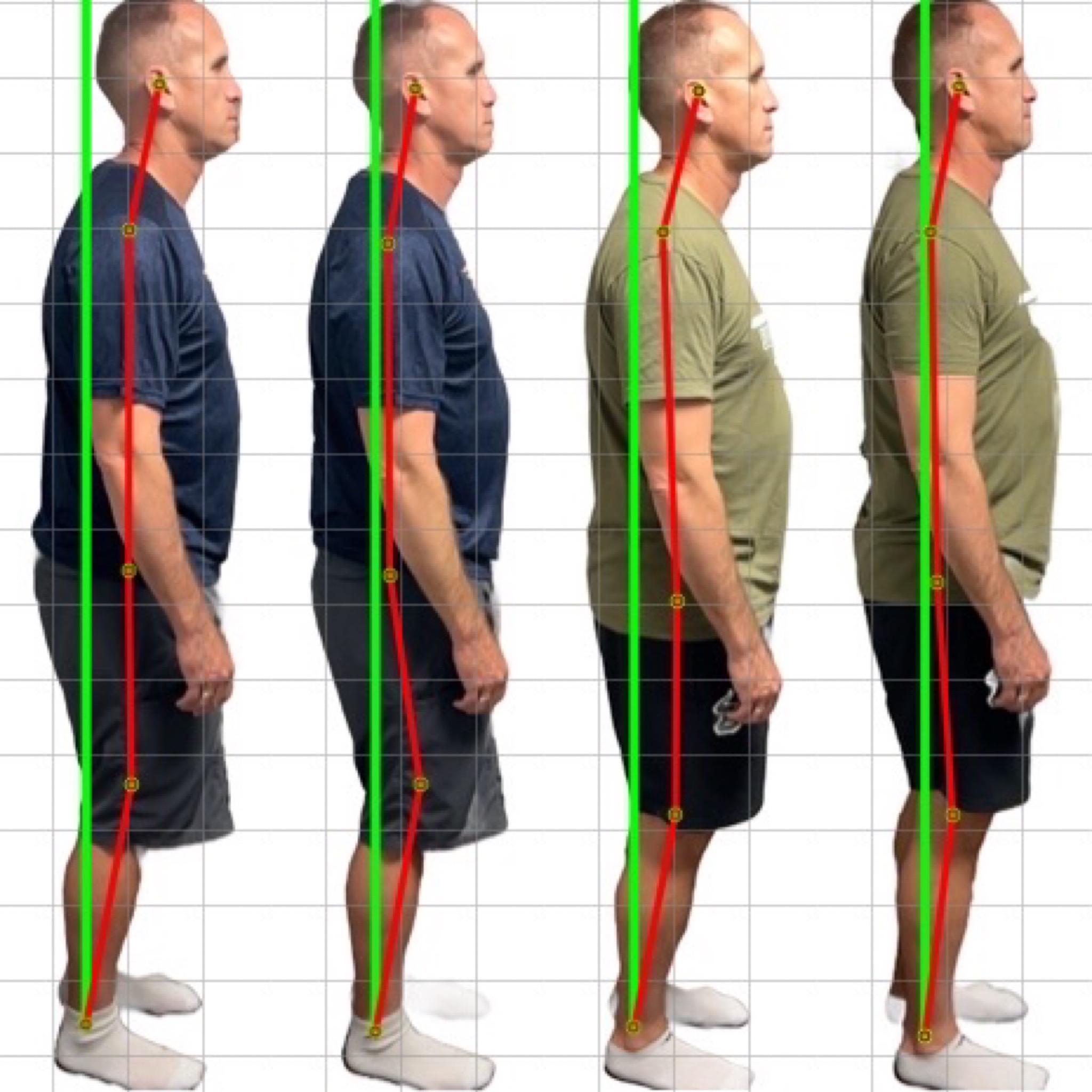 Patient posture transformation 3