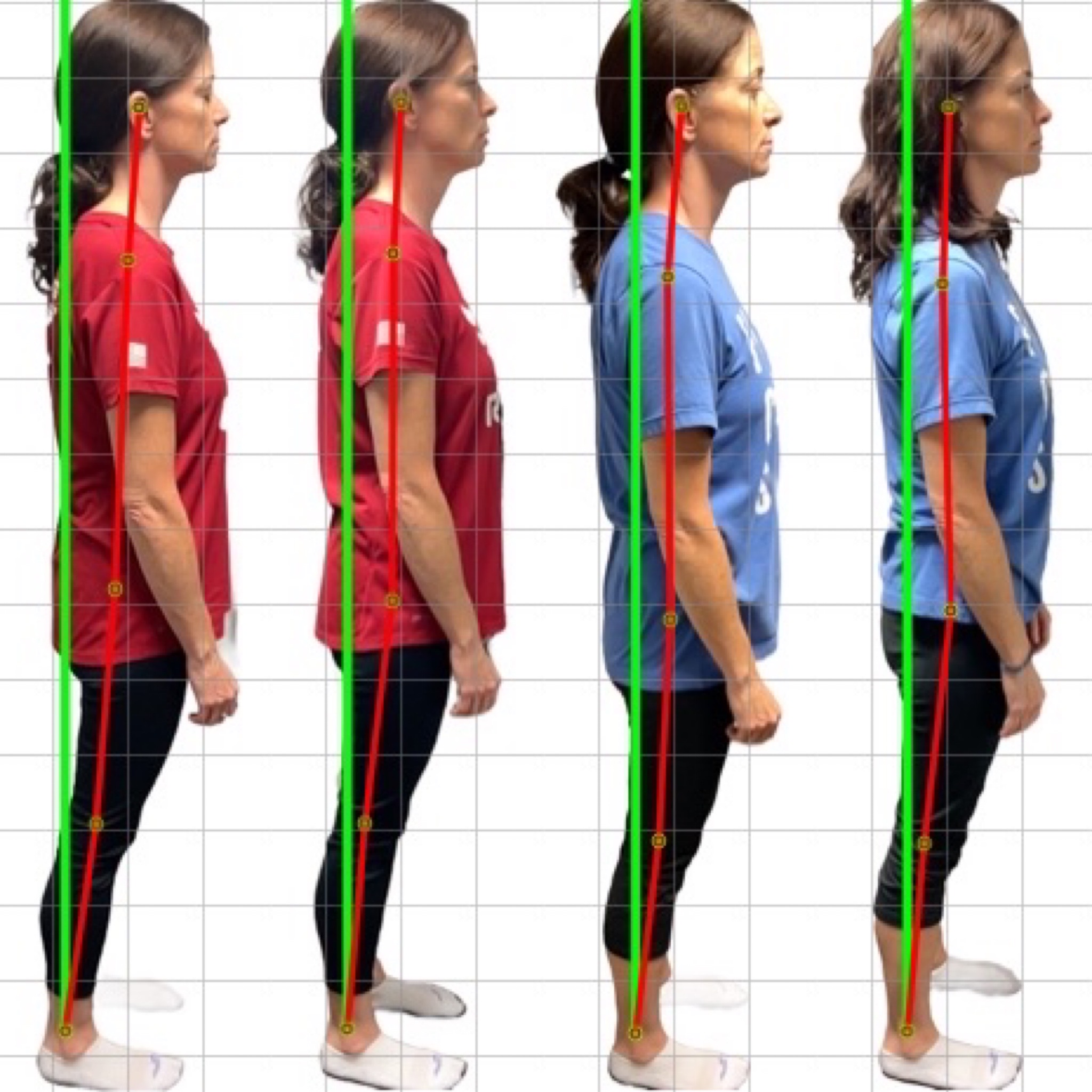 Patient posture transformation 5
