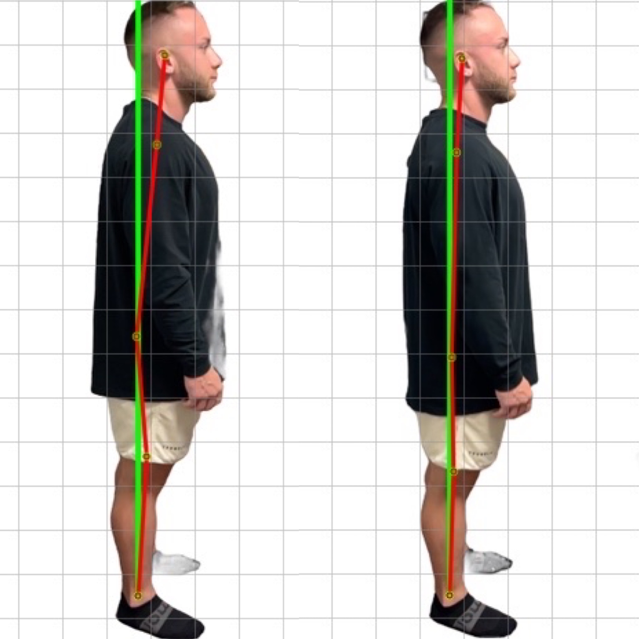 Patient posture transformation 4