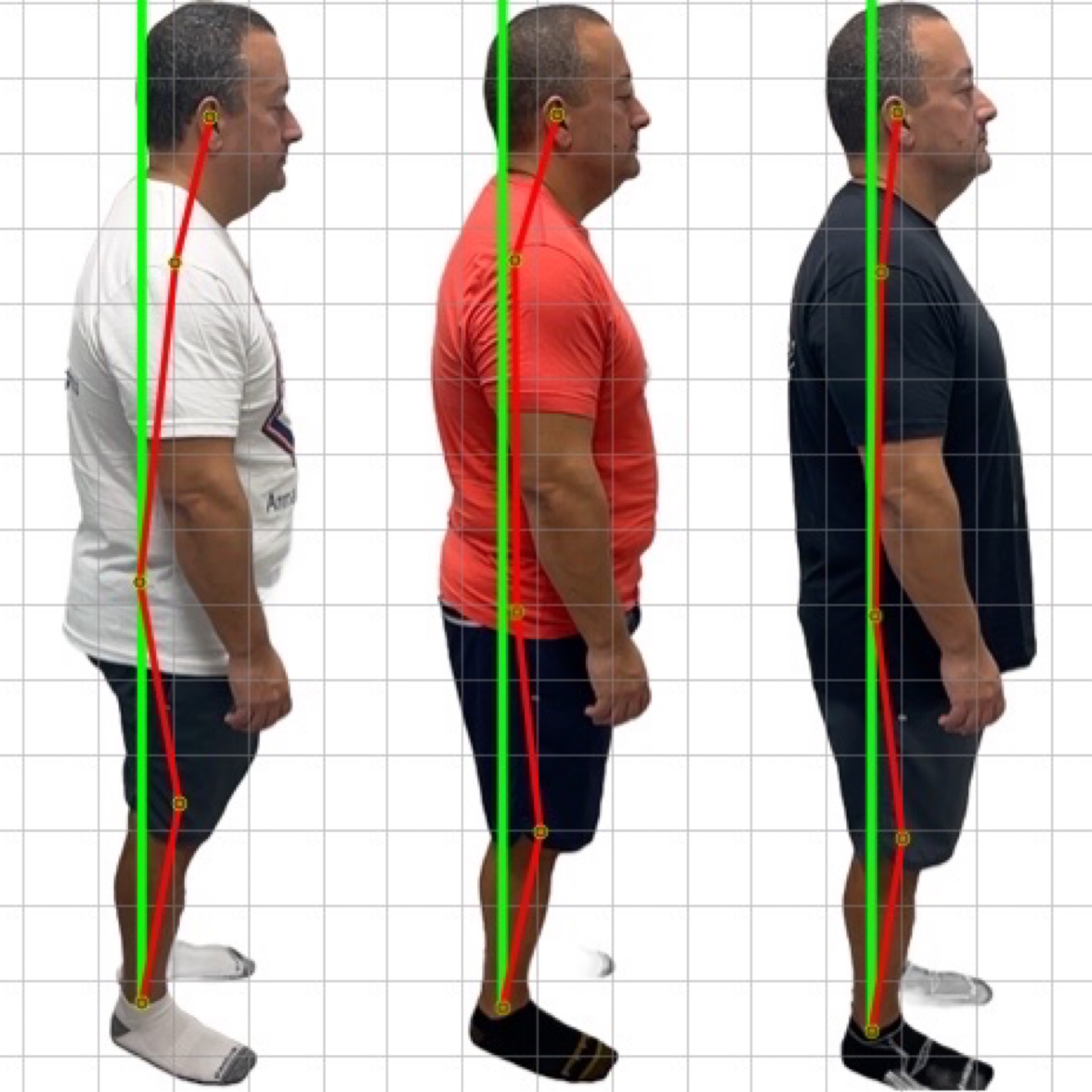 Patient posture transformation 6