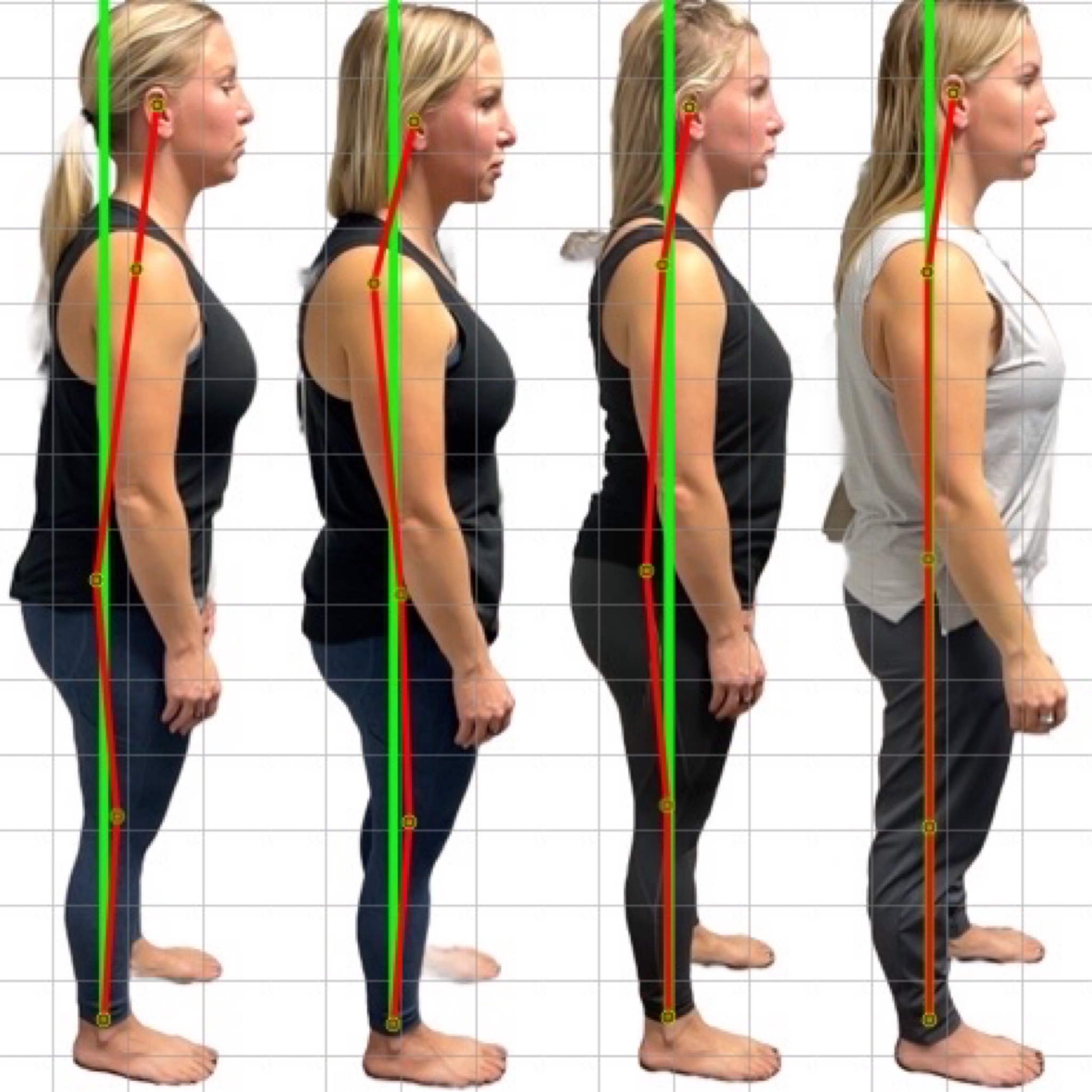 Patient posture transformation 7