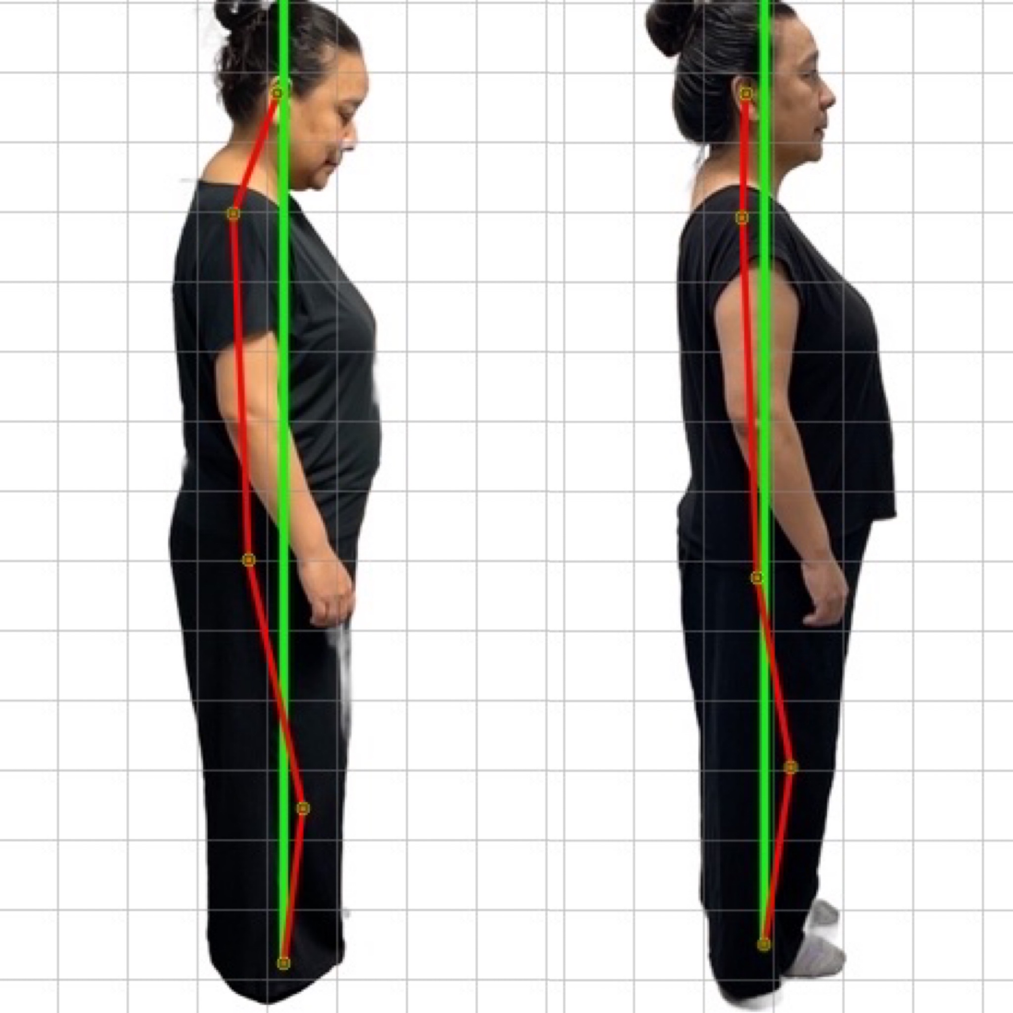 Patient posture transformation 8