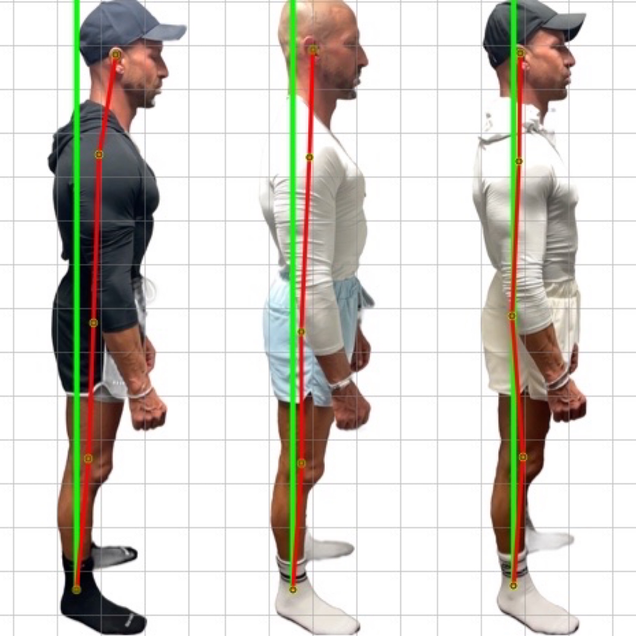 Patient posture transformation 9