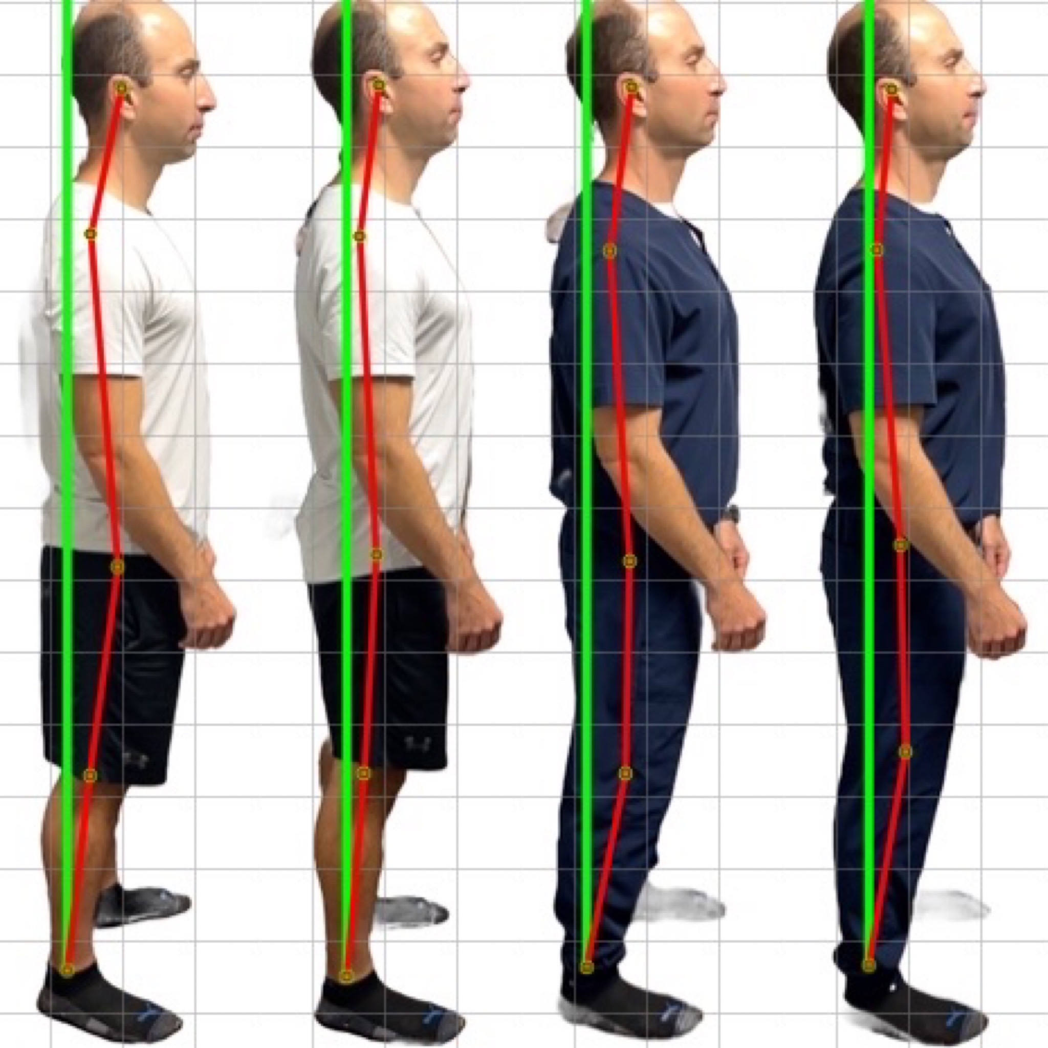 Patient posture transformation 10
