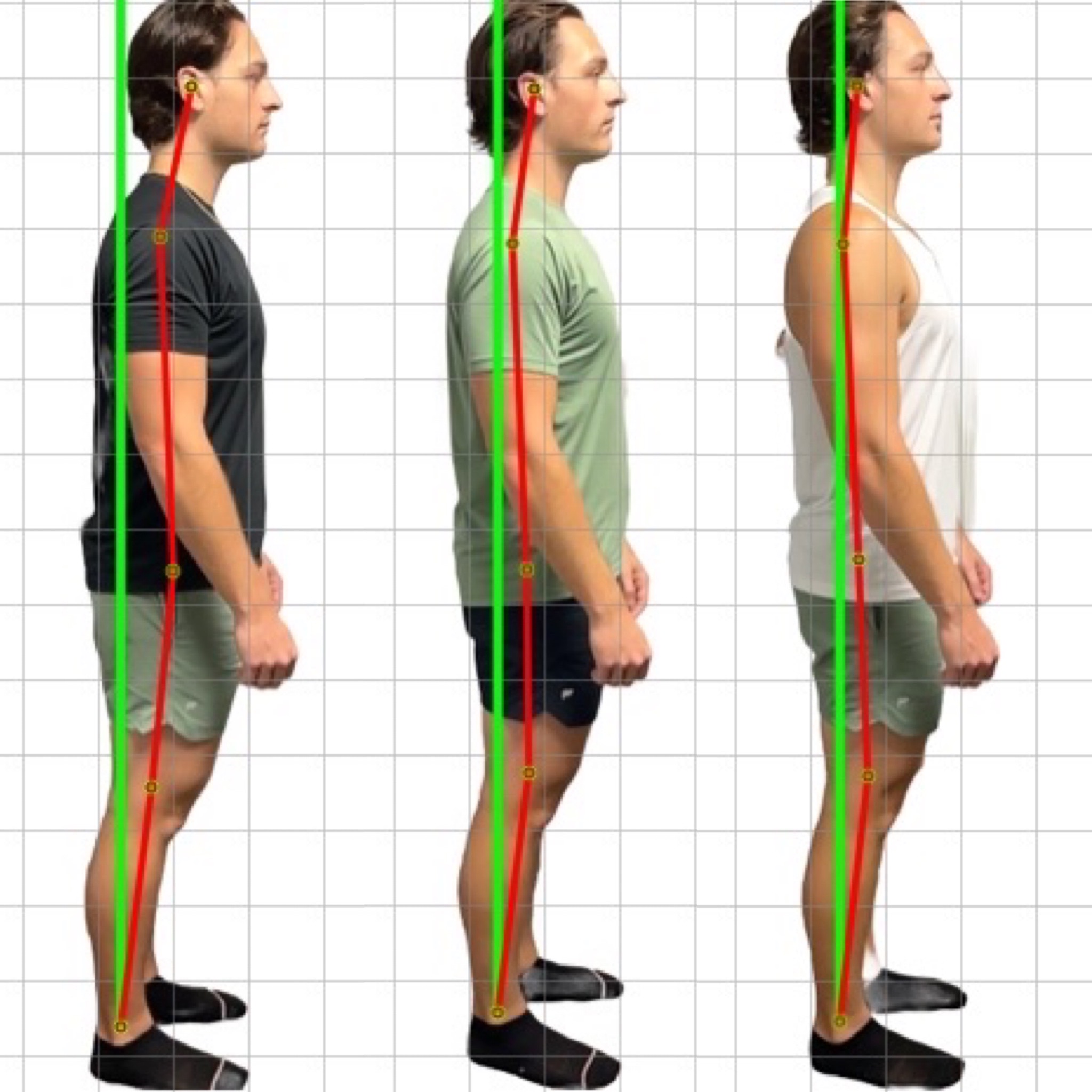 Patient posture transformation 11